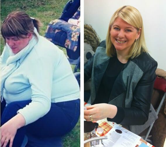 Two pictures of a woman before and after weight loss.