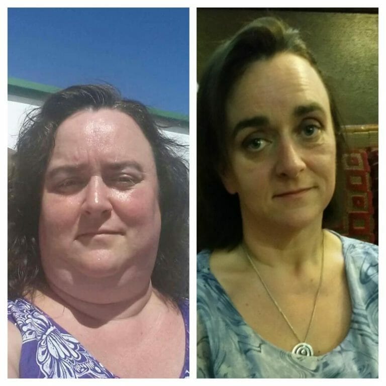 Two pictures of a woman before and after weight loss.